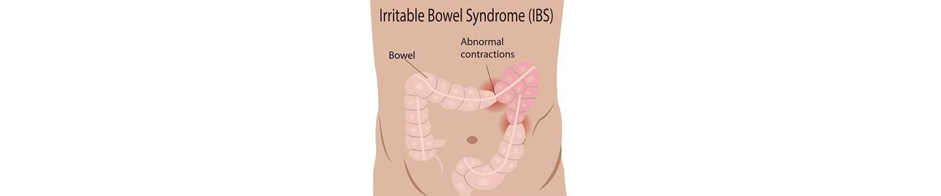 Irritable Bowel Syndrome treatment in Mumbai